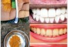 Teeth whitening in just 2 minutes – turning yellow and accumulated tartar into milk-like white and shiny. Full recipe in the first comment.. 07:11:26